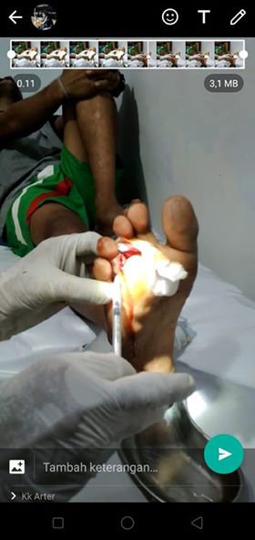 R. Silaya umur 27 Tahun, status belum bekerja ke RS.Tentara dr. J. latumeten Ambon di hari minggu Pukul 19.00 Wit malam, dimana pihak korban dibawa untuk mendapatkan penanganan pertama, tetapi pihak RST minta harus di rapit tes dulu dengan harga Rp.500.00,00 akhirnya si Korban memutuskan untuk pulang dan menjalani perawatan di Rumah.